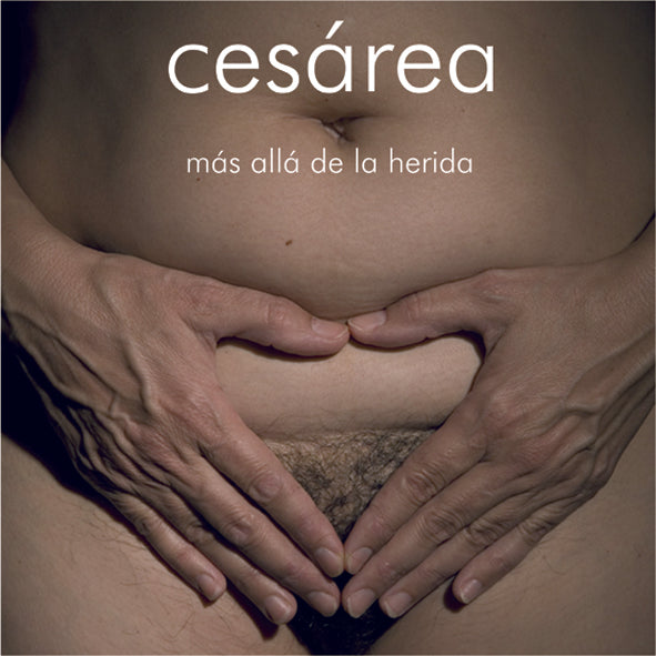 Cesárea, más allá de la herida
